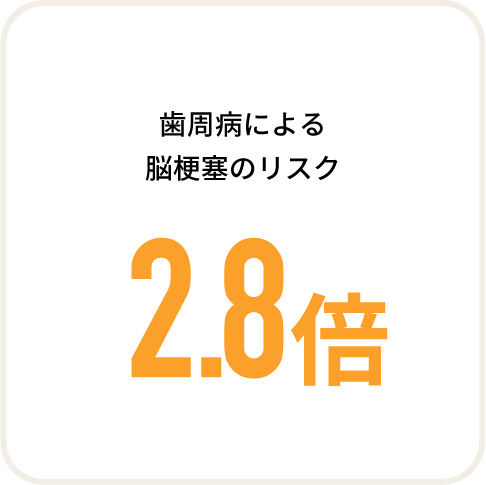 歯周病による脳梗塞のリスク 2.8倍